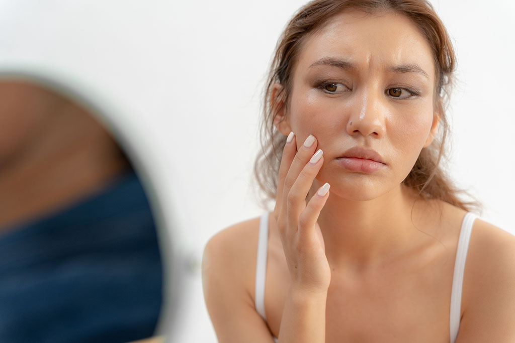 Closeup of a Young Woman Concerningly Looking at Her Face in a Mirror Experiencing the Effects of PCOS