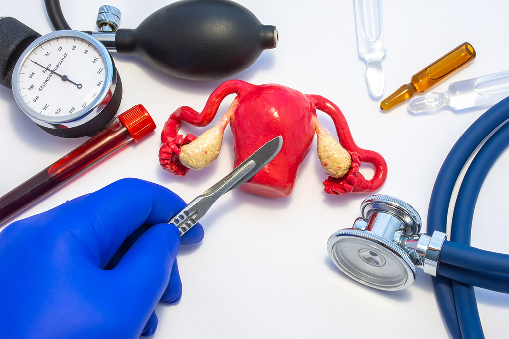 A Doctor Holding A Scalpel Above An Anatomical Figure What Is A Total Hysterectomy